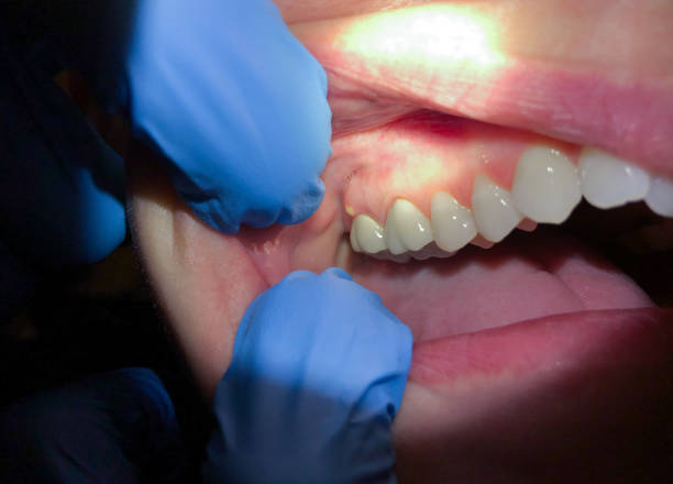 Best Cracked Tooth Emergency Dentist  in Azle, TX