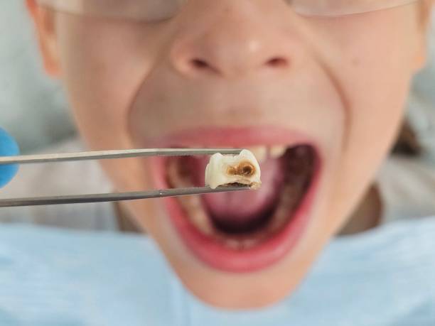 Best Broken Tooth Emergency  in Azle, TX